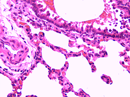 chronic obstructive pulmonary disease model