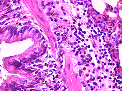 chronic obstructive pulmonary disease model