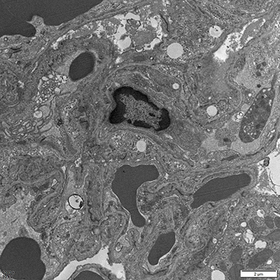 chronic obstructive pulmonary disease model
