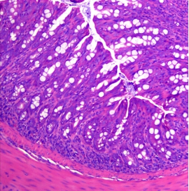 dss induced colitis model